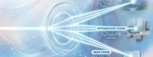 Multifocal